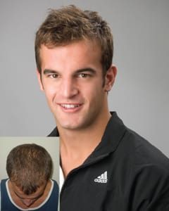 Laser Hair Growth & Restoration NZ - Proven Hair Regrowth Laser Hair Growth & Restoration NZ - Proven Hair Regrowth