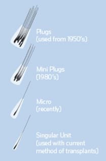 Strand By Strand Surgical technique