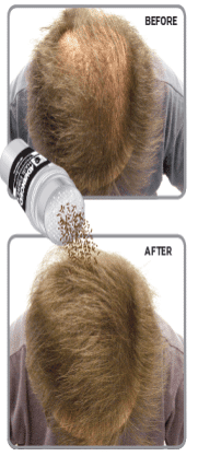 Hair Thickening Treatments - Thickener Products NZ