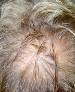 Shane Warne_before
