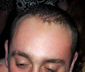 John McDonald Before
