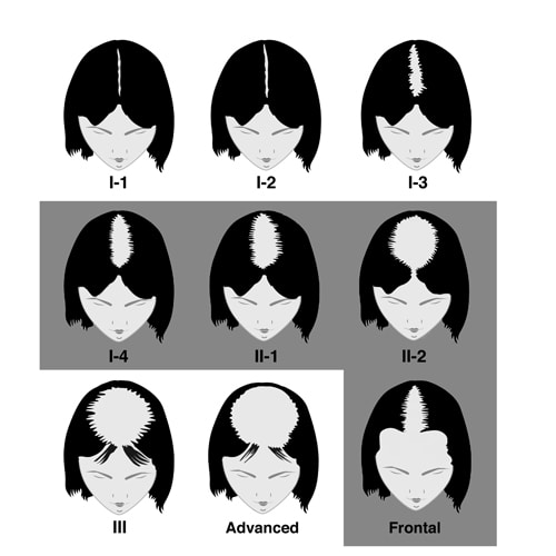 Savin Scale Female