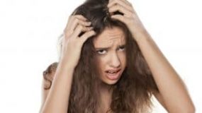 Hair Loss in Women