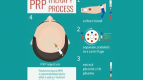 PRP Therapy Process