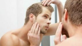 Propecia and Hair Loss