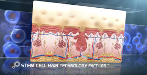Stem Cell Treatment New Zealand