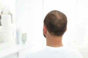 The Absolute Best Haircuts For A Receding Hairline
