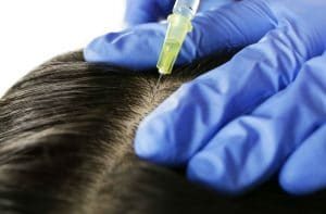 Want-the-Best-FUE-Hair-Transplant-in-Sydney