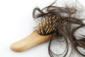The Best Hair Loss Treatment For Females