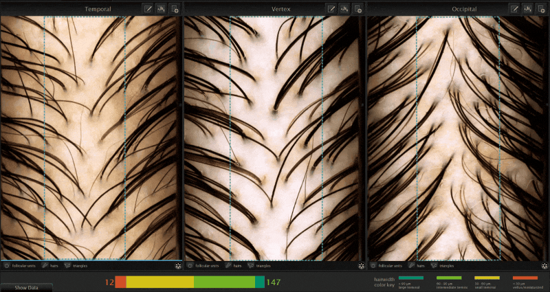 Advanced Hair Analysis Gif